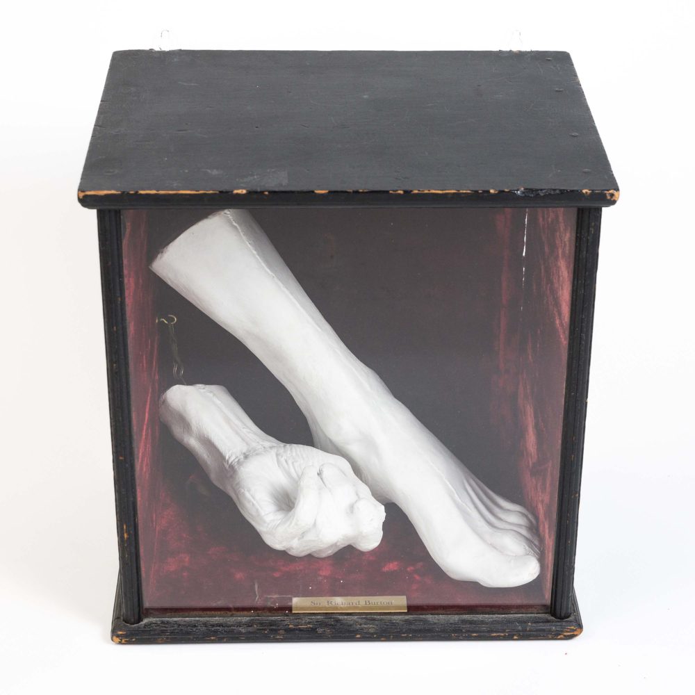 Burton’s hand and foot